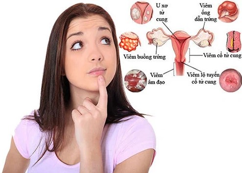 Bệnh phụ khoa là bệnh gì