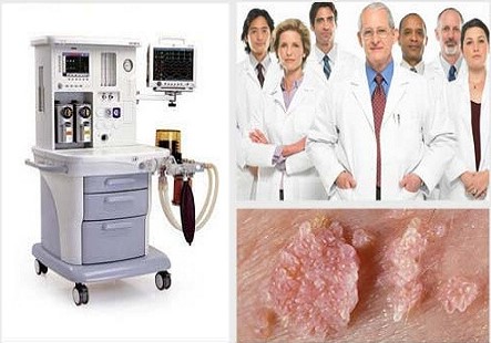 Điều trị sùi mào gà hết bao nhiêu tiền