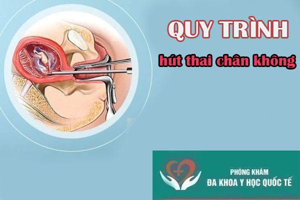 Quy trình hút thai diễn ra như thế nào