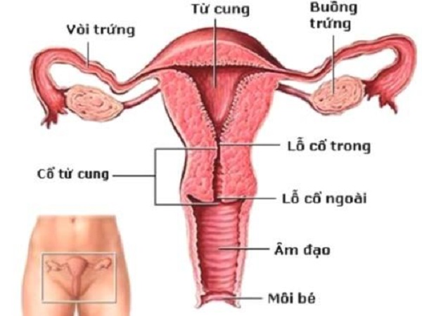 Viêm cổ tử cung là gì